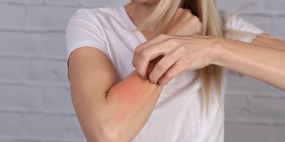 Alergi Seafood? Cobalah Cara-Cara Berikut !