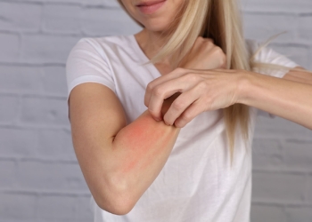 Alergi Seafood? Cobalah Cara-Cara Berikut !