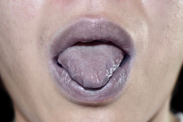 warna lidah biru ungu