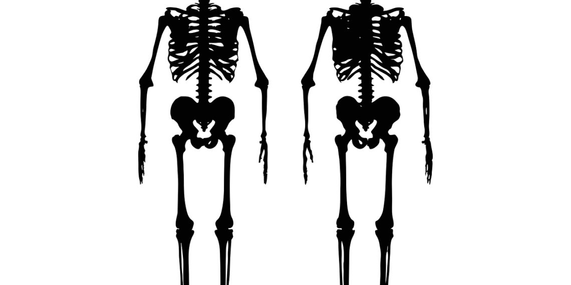 penyakit osteoporosis